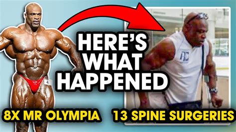 what happened to ronnie coleman spine